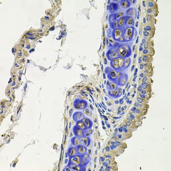 SKP1 Antibody
