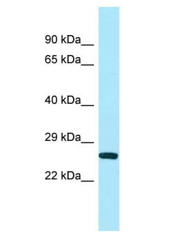 UQCC1/ UQCC Antibody (aa68-117)