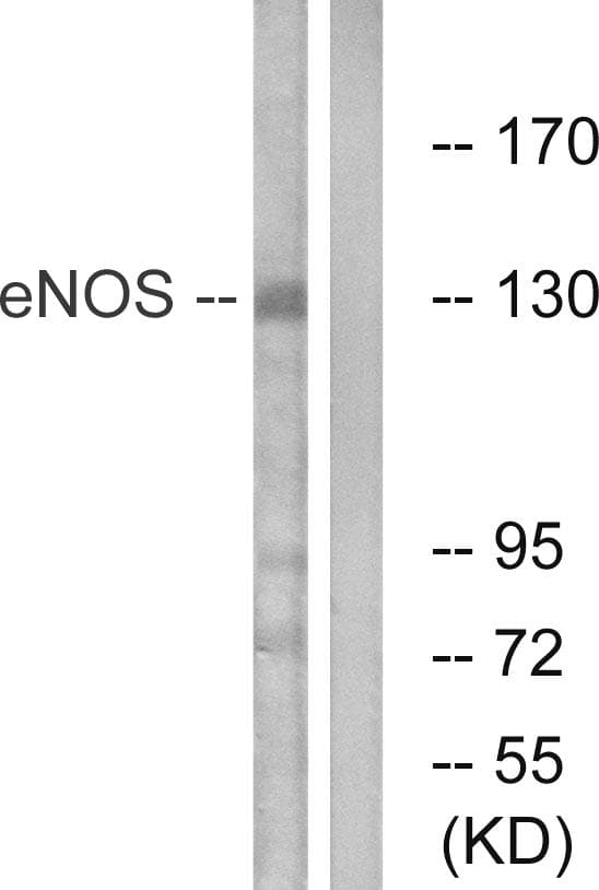 NOS3 / eNOS Antibody (p615)