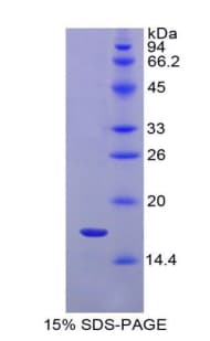 Rat IL1R1 Protein (Recombinant His)
