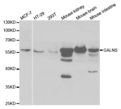 GALNS / Chondroitinase Antibody