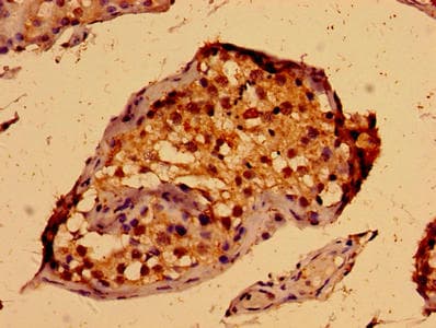 PORCN Antibody