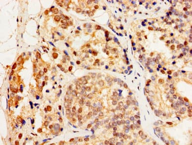 HSF2 Antibody