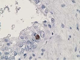 HDHD2 Antibody (clone OTI1A5)