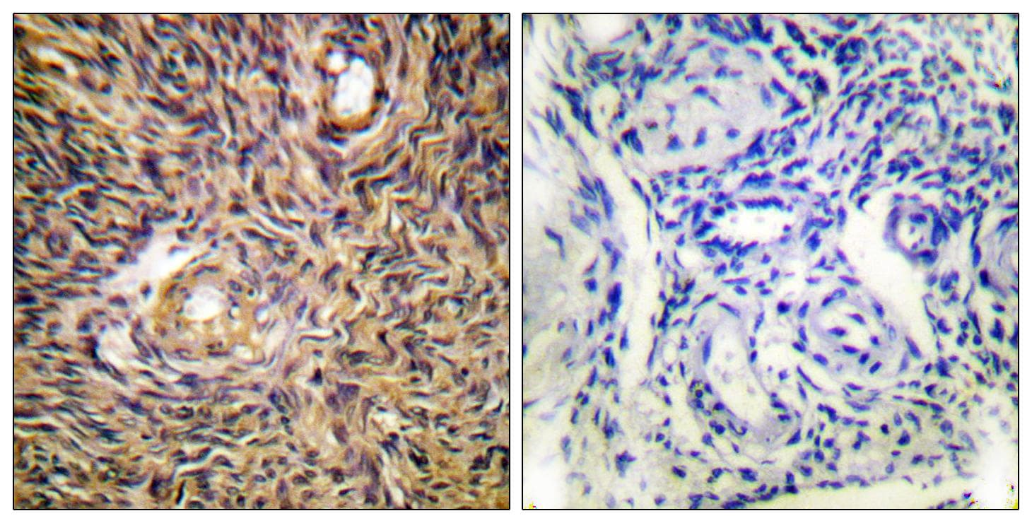Polyclonal Rabbit anti-Human ACO1 / Aconitase Antibody (Ab-138, IHC, IF)