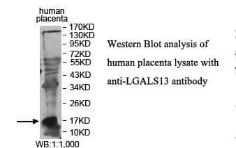 Polyclonal Rabbit anti-Human LGALS13 / Galectin 13 Antibody (aa15-114, IHC, WB)