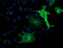 SH2B3 / LNK Antibody (clone OTI2B11)