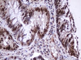 MKI67 / Ki67 Antibody (clone OTI3B8)