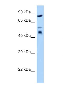 TES / Testin Antibody (aa203-252)