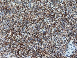 MAP2K1 / MKK1 / MEK1 Antibody (clone OTI1F9)