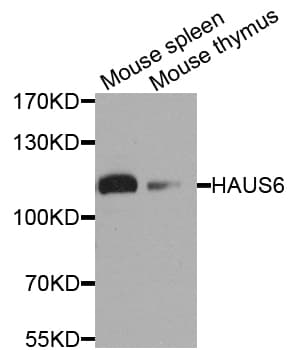 Polyclonal Rabbit anti-Human HAUS6 / FAM29A Antibody (WB)