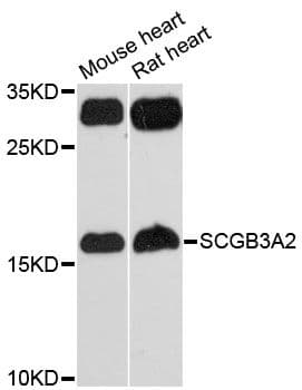 Polyclonal Rabbit anti-Human SCGB3A2 Antibody (WB)