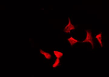 RELB Antibody (phospho-Ser552)
