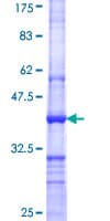 Human PRMT4 / CARM1 Protein (Recombinant GST, N-terminus)