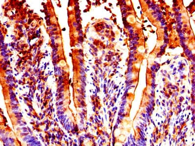 Polyclonal Rabbit anti-Human GUCA2B / Uroguanylin Antibody (aa37-112, IHC)