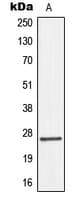 GJB2 / CX26 / Connexin 26 Antibody (Internal)