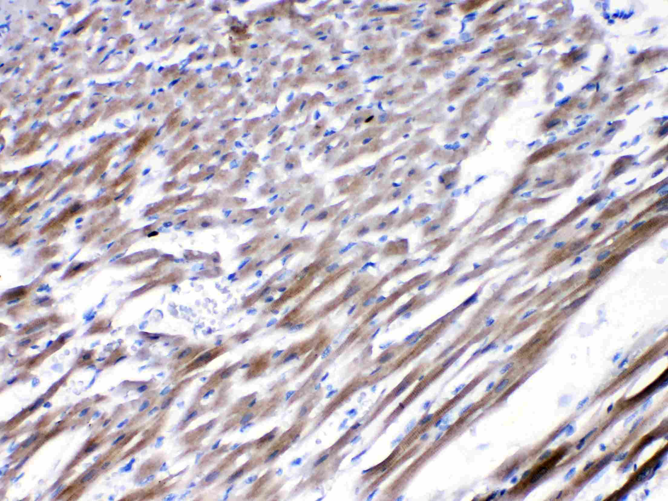 Polyclonal Rabbit anti-Human CHRNA5 Antibody (IHC, WB)