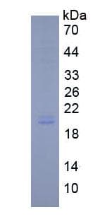 Human IL11 Protein (Recombinant His, N-Terminal)