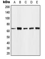 Polyclonal Rabbit anti-Human FOXO4 / AFX1 Antibody (phospho-Thr451, WB)