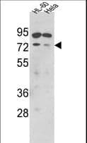 SENP1 Antibody (aa560-590)