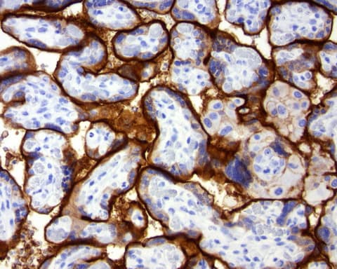CD274 / B7-H1 / PD-L1 Antibody (C-Terminus, clone OR-5E3)