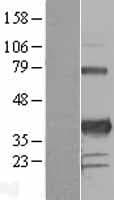 PITX3 Protein (Over-Expression Lysate Myc-DDK (Flag))