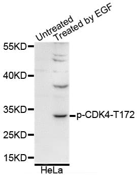 CDK4 Antibody (phospho-Thr172)
