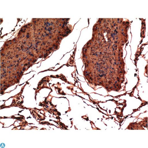 Monoclonal Mouse anti-Human BAX Antibody (IHC, WB)