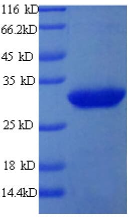 Human ART1 /CD296 Protein (Recombinant 6His, N-terminus)