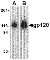 Polyclonal Rabbit anti-Virus HIV-1 gp120 Antibody (WB)