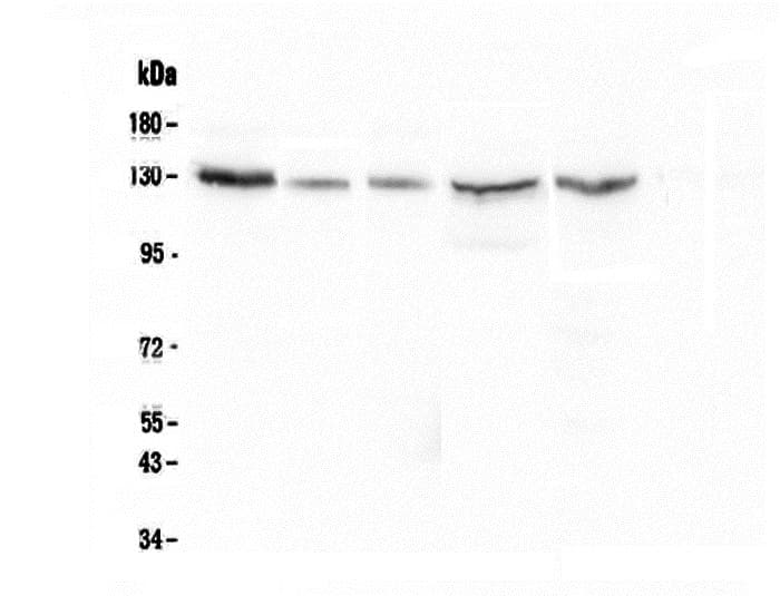 CASR/Calcium Sensing Receptor Antibody