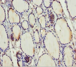 MTUS1 Antibody