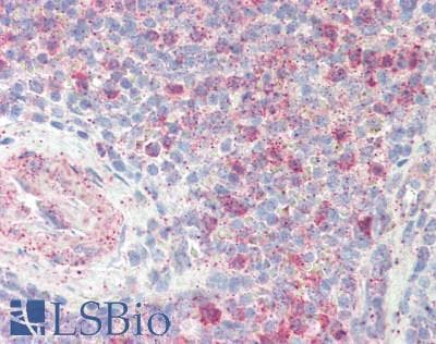 IHC-plus™ Polyclonal Rabbit anti-Human Complement C5 Antibody (IHC)