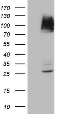 IKBKE / IKKI / IKKE Antibody (aa474-716, clone OTI1E4)
