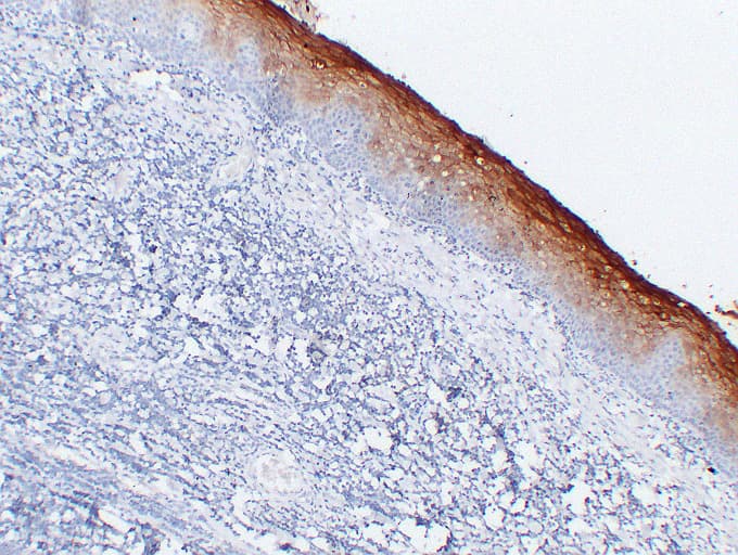 CEACAM5 / CD66e Antibody (clone ABT-CEA)