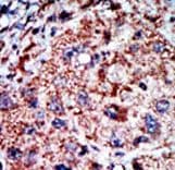 PFKL Antibody (aa669-699)