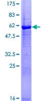 Human MAP3K7CL / TAK1L Protein (Recombinant GST)