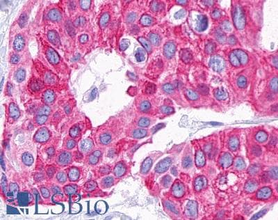 PathPlus™ P2RY14 / GPR105 Antibody (C-Terminus)