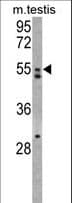 Polyclonal Rabbit anti-Human AMHR2 / MISRII Antibody (aa13-42, WB)