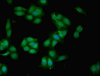 BGN / Biglycan Antibody