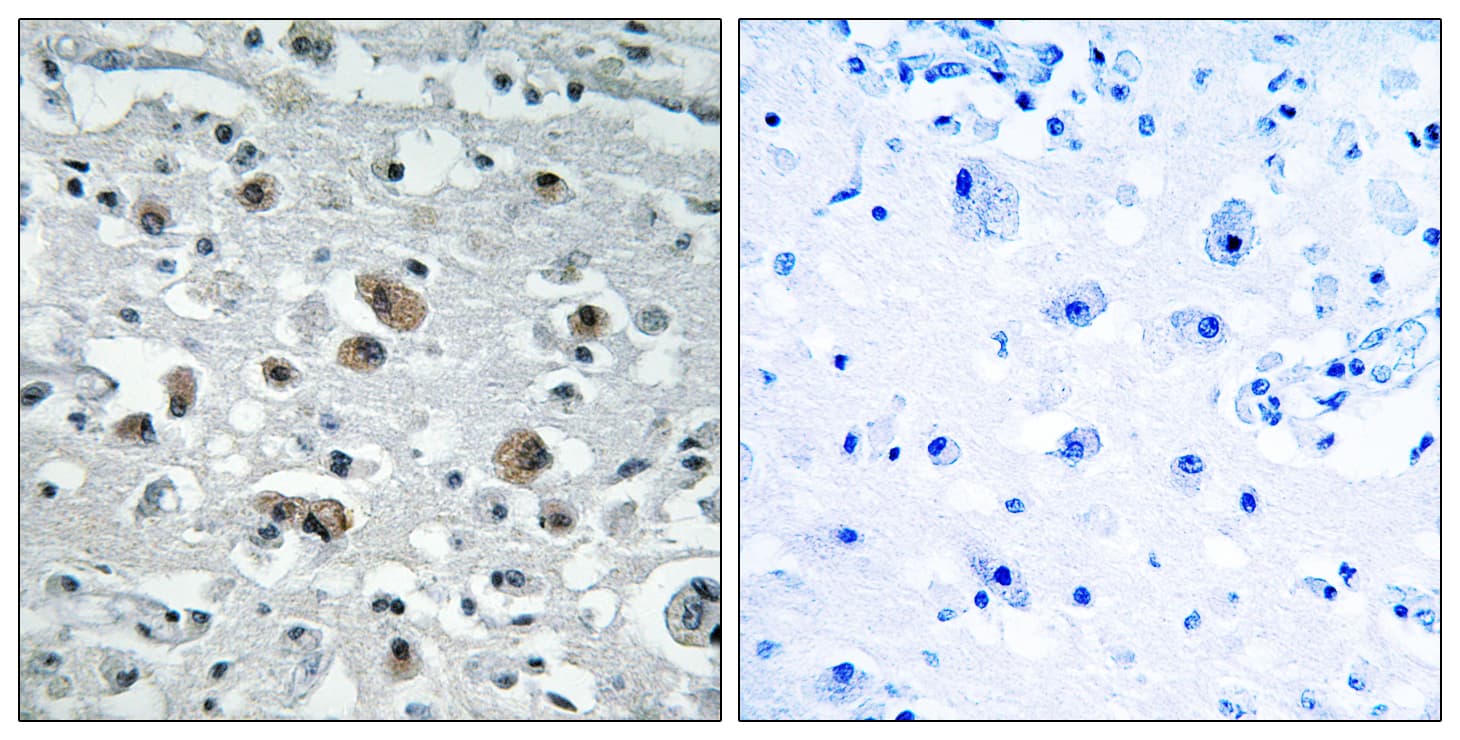 Polyclonal Rabbit anti-Human GPRASP1 / GASP-1 Antibody (aa741-790, IHC, IF)