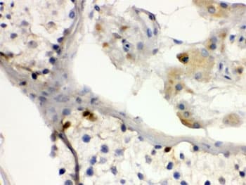DMRT1 Antibody