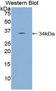 NUP98 Antibody (aa629-894)
