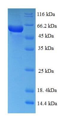 Human MAPK13 / p38delta Protein (Recombinant His-SUMO)
