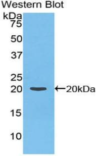 F2 / Prothrombin / Thrombin Antibody (aa44-200)