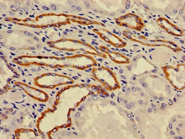ATP6V0A1 Antibody