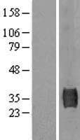 SUSD3 Protein (Over-Expression Lysate Myc-DDK (Flag))