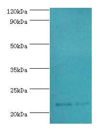 SRI / Sorcin Antibody (aa1-198)