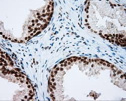 NPR3 Antibody (clone OTI4C3)