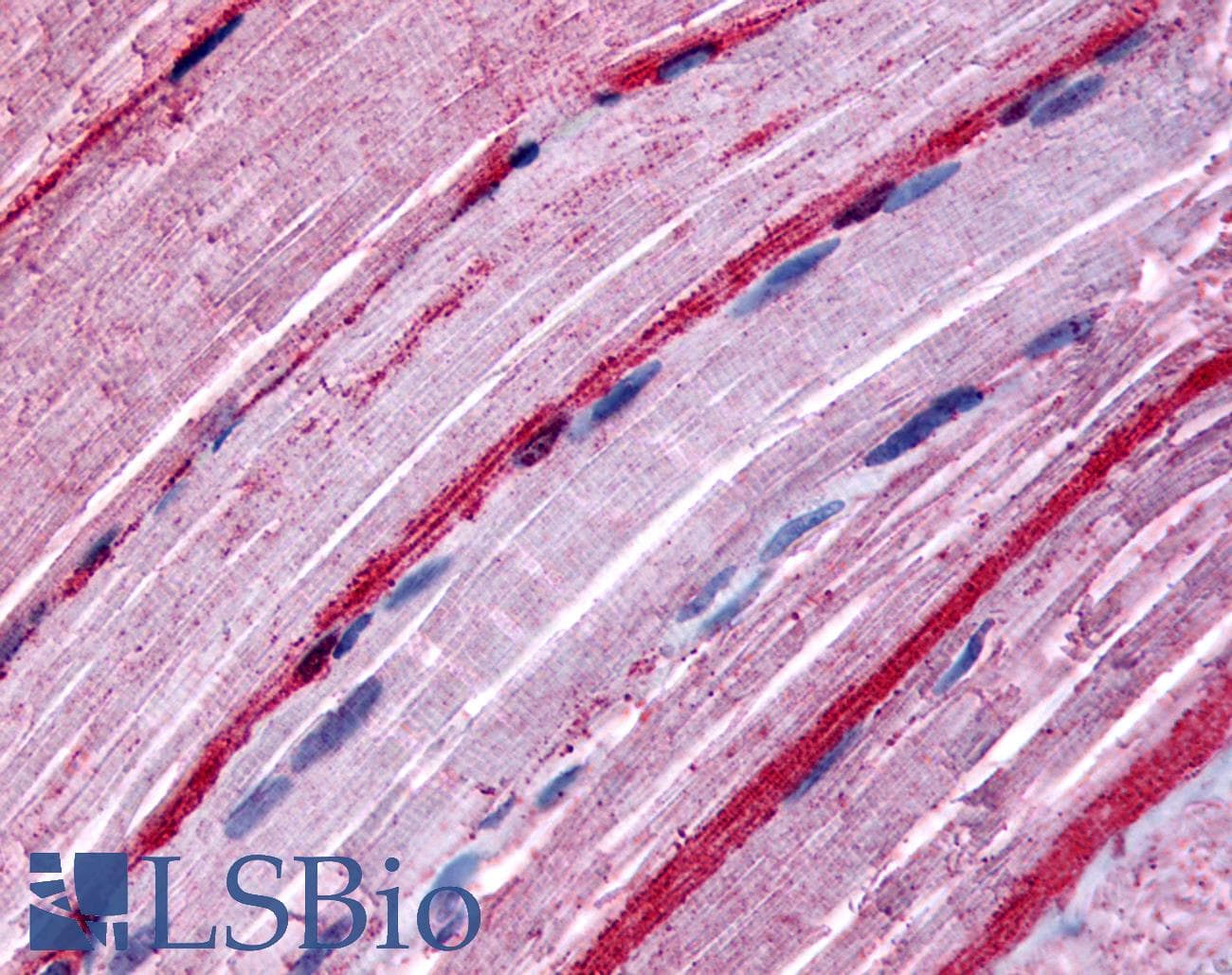 IHC-plus™ Polyclonal Rabbit anti-Human GRK5 Antibody (Internal, IHC)